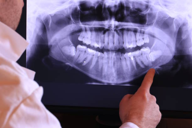 Best Emergency TMJ Treatment in Rose Hills, CA