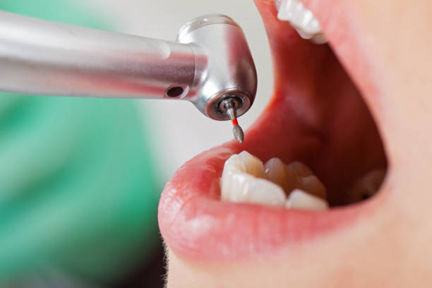 Best Weekend Emergency Dentist in Rose Hills, CA
